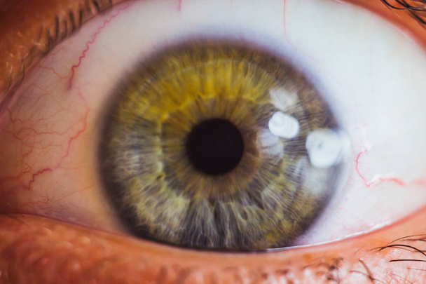 wijd open menselijk oog met heldere rode slagaders van dichtbij. irritatie en roodheid van de oogbol. pupillen, iris, wimpers in macro - Foto, afbeelding