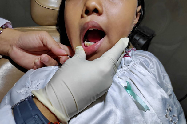 pieni lapsi tarkistaa hampaansa hammaslääkärillä, koska hänen hampaansa ovat onttoja, kaikki ilman pelkoa
 - Valokuva, kuva