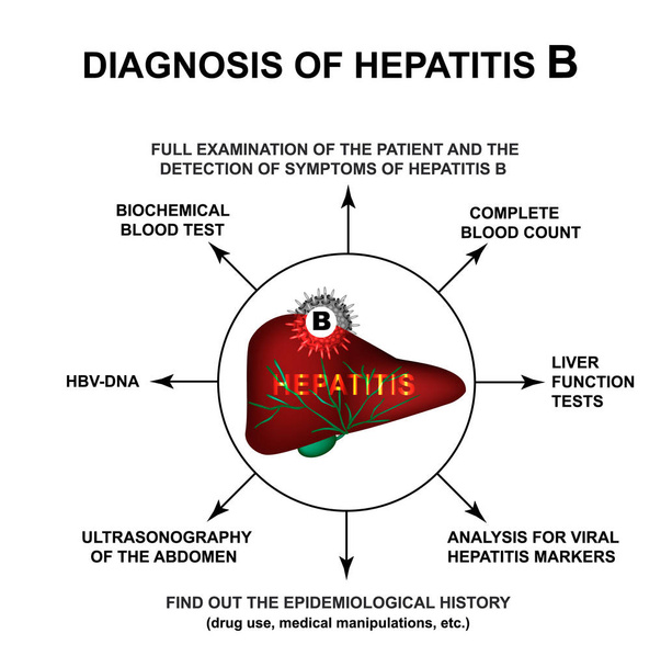 B-hepatiitin diagnosointi Maailman hepatiittipäivä. Infografiikkaa. Vektorin kuva eristetyllä taustalla
. - Vektori, kuva
