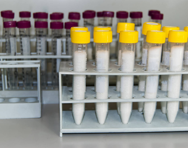 Set van laboratorium reageerbuis met gele dop op display - Foto, afbeelding