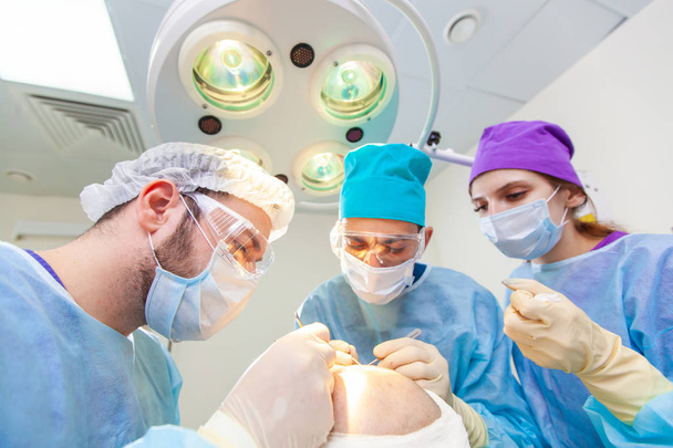 Baldness treatment. Hair transplant. Surgeons in the operating room carry out hair transplant surgery. Surgical technique that moves hair follicles from a part of the head. - 写真・画像