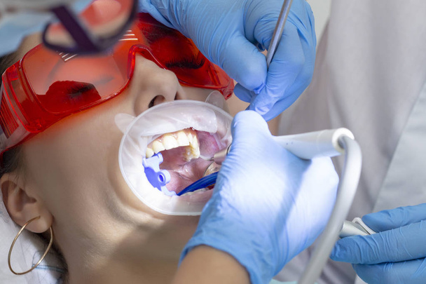 girl at the reception at the dentist. treatment of carious tooth. on top of your teeth caries. dentists use special medical instruments for treatment, mirror, boron machine - Photo, Image