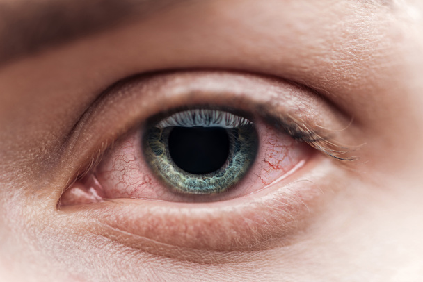 vue rapprochée de l'œil humain avec capillaires rouges
 - Photo, image