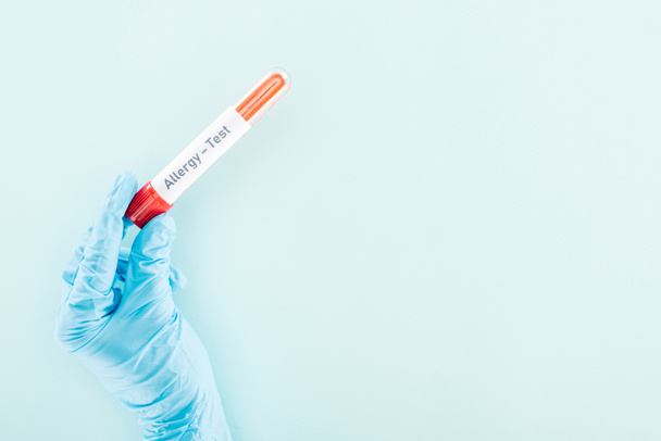 vista recortada del médico que sostiene la muestra en tubo de ensayo con inscripción de prueba de alergia aislada en azul
 - Foto, Imagen