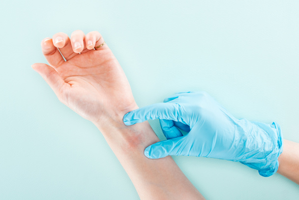 vista recortada del médico que examina la reacción alérgica en la mano del paciente en azul
  - Foto, Imagen