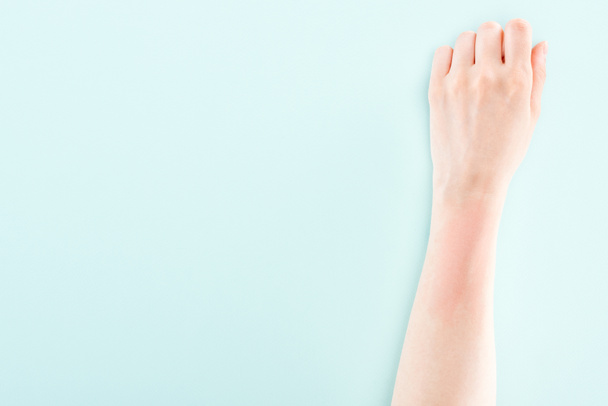 wykadrowany widok dłoni z reakcją alergiczną wyizolowaną na niebiesko - Zdjęcie, obraz