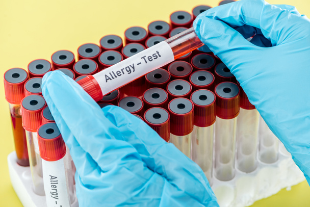 cropped view of doctor in latex gloves holding sample with allergy test inscription above empty test tubes isolated on yellow - Fotó, kép