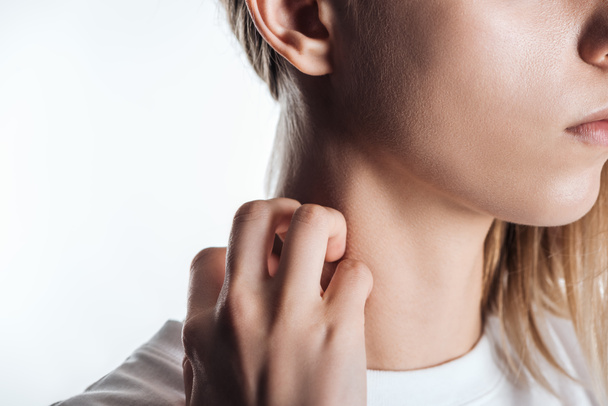 cropped view of woman itching neck on white background - Photo, Image