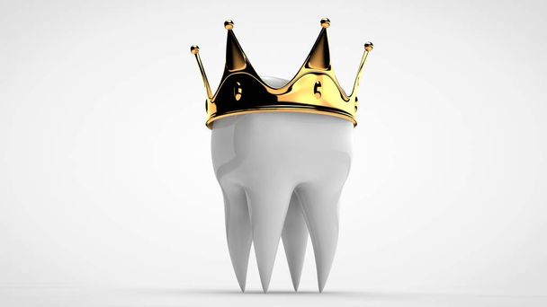 Representación en 3D de un diente humano blanco coronado con una corona de oro. La idea de tratamiento, restauración, prótesis en una clínica dental. Imagen 3D sobre fondo blanco, aislada
. - Foto, imagen