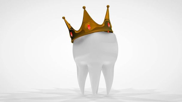 Representación en 3D de un diente humano blanco coronado con una corona de oro. La idea de tratamiento, restauración, prótesis en una clínica dental. Imagen 3D sobre fondo blanco, aislada
. - Foto, imagen