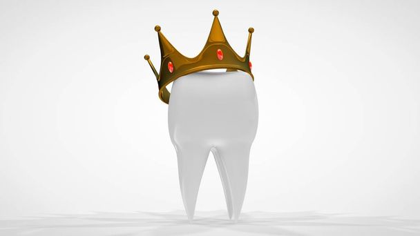 3D рендеринг белого человеческого зуба, увенчанного золотой короной. Идея лечения, реставрации, протезирования в стоматологической клинике. 3D изображение на белом фоне, изолированное
. - Фото, изображение