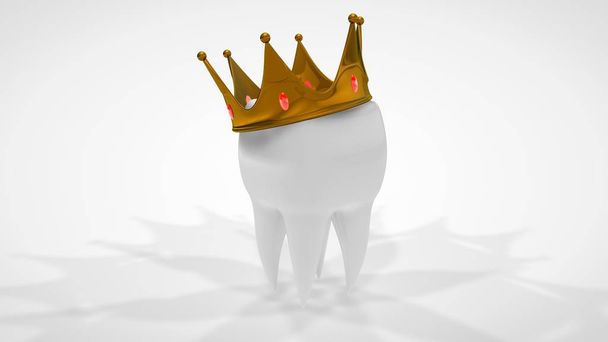 Renderização 3D de um dente humano branco coroado com uma coroa de ouro. A ideia de tratamento, restauração, próteses em uma clínica odontológica. Imagem 3D sobre um fundo branco, isolado
. - Foto, Imagem