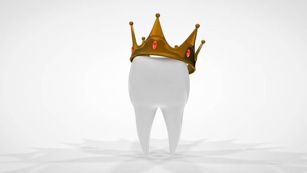 3D-rendering van een witte menselijke tand bekroond met een gouden kroon. Het idee van behandeling, restauratie, protheses in een tandheelkundige kliniek. 3D-afbeelding op een witte achtergrond, geïsoleerd. - Foto, afbeelding
