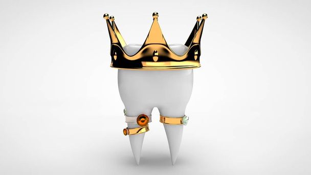 Representación en 3D de un diente humano blanco con una corona de oro y anillos con piedras preciosas. La idea de una vida lujosa, tratamiento caro y de alta calidad, prótesis. Imagen aislada
 - Foto, Imagen