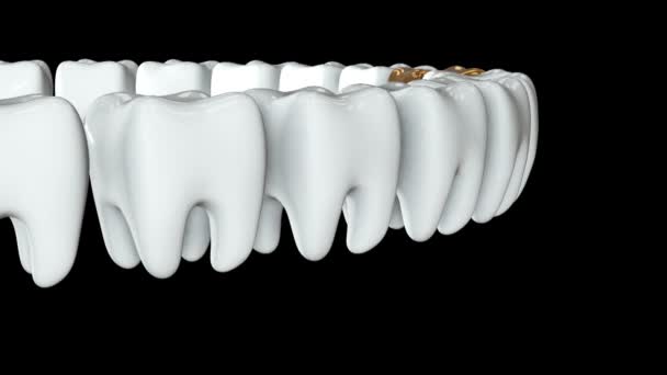 Gouden tand in een rij van de witte tanden. 3d. - Video