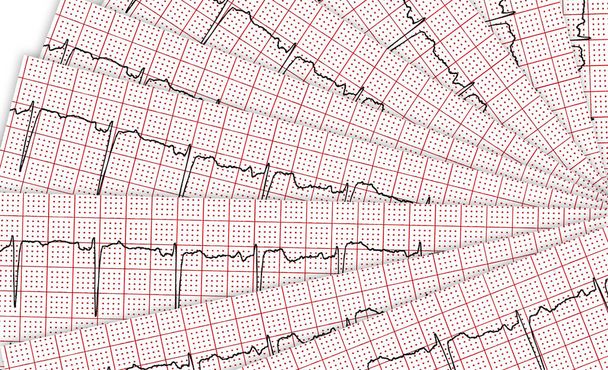 Cardiogram. Néhány kutatási eredmény a cu - Fotó, kép