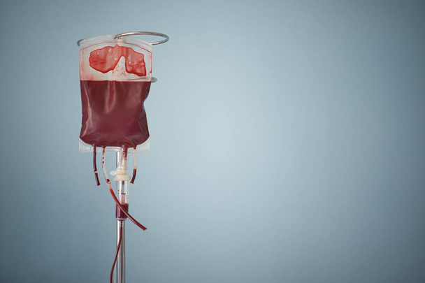 transfusion of blood, bag with red blood cells on stand - Foto, imagen