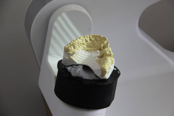 a vetítések szkennelése 3D szkenneren a műfogsor gyártásához - Fotó, kép
