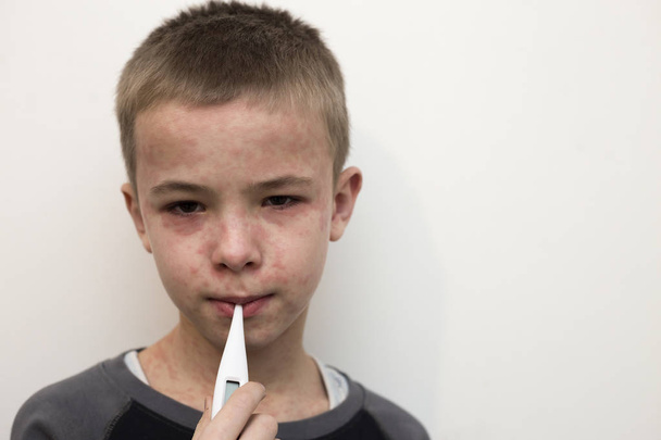 Beteg szomorú fiú gyermek hőmérővel, amelynek láz suf portréja - Fotó, kép