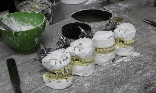 η κατασκευή οδοντικών πρόστριβων στο οδοντιατρικό εργαστήριο από γύψο - Φωτογραφία, εικόνα