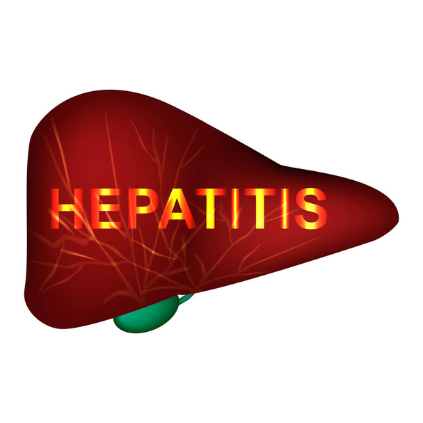 Hepatitis A, B, C, D, E, F, G. wereld hepatitis dag. Infographics. Vector illustratie op geïsoleerde achtergrond. - Vector, afbeelding
