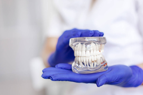 Un dentista sostiene una muestra de dientes de mandíbula en un consultorio dental
. - Foto, Imagen