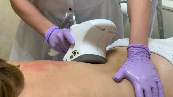 Hautpflege. Kosmetologe macht eine Frau lpg Massage auf dem Rücken - Filmmaterial, Video
