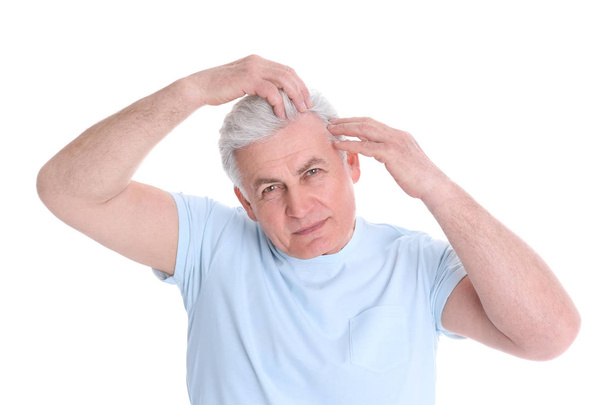 Senior man with hair loss problem isolated on white - Fotó, kép