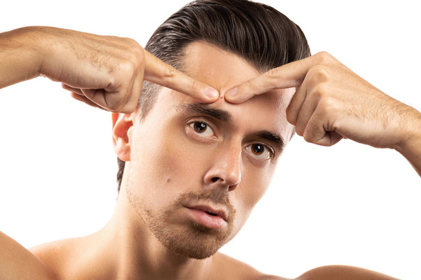 Young man is squeezing pimple on his forehead - Photo, image