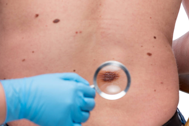 Dermatólogo examinando la piel en la parte posterior de un paciente - Foto, Imagen