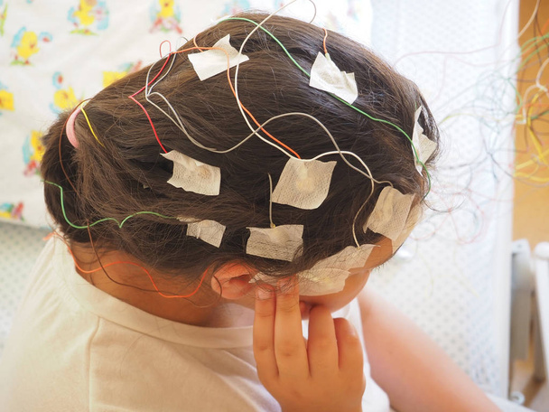 医学のテストのための彼女の頭に接続されている脳波電極を持つ少女 - 写真・画像