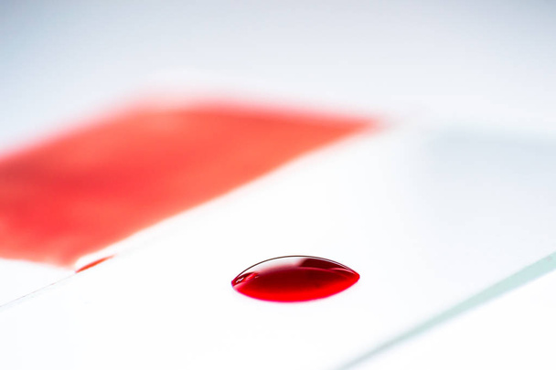 Κηλίδα αίματος για μικροσκοπική εξέταση Αιματολογίας - Φωτογραφία, εικόνα