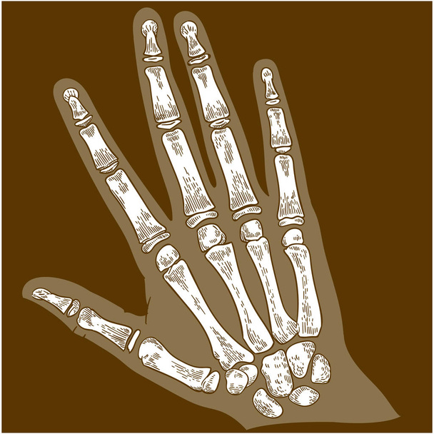 Gravur Illustration von Handknochen Röntgen - Vektor, Bild