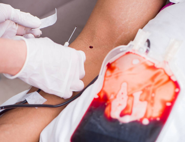 Pacient podstupující transfuzi krve na nemocniční klinice - Fotografie, Obrázek