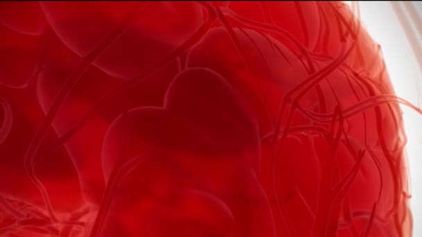 Медична анімація знаменитої кровотечі
 - Кадри, відео