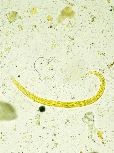 Larve d'Aelurostrongylus abstrusus isolée, au microscope
 - Photo, image