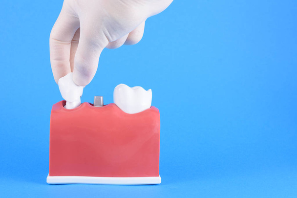 Mavi arka planda yanlış ağız diş hekimi - Fotoğraf, Görsel