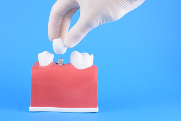 Mavi arka planda yanlış ağız diş hekimi - Fotoğraf, Görsel