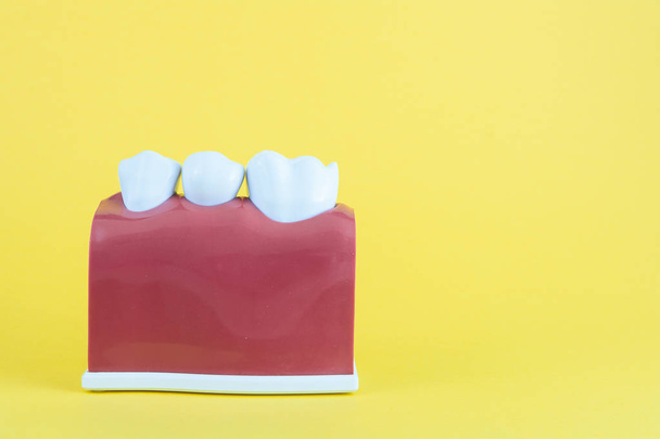 Falsa boca sobre fondo amarillo con cepillo de dientes
 - Foto, Imagen