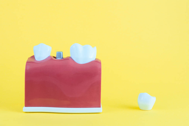 False suun keltaisella pohjalla hammasharjalla
 - Valokuva, kuva