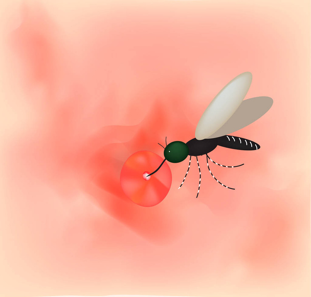 Mosquito bite on the skin. World mosquito day. Vector illustration on isolated background. - Vector, Image