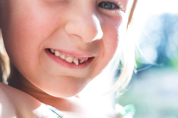 Retrato de uma menina com um dente de leite oscilante
 - Foto, Imagem
