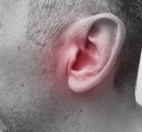Mann verletzt sich am Ohr ein Symptom der Krankheit - Foto, Bild