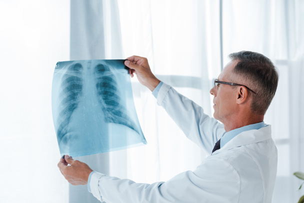 médico de casaco branco e óculos segurando raio-X no hospital
  - Foto, Imagem