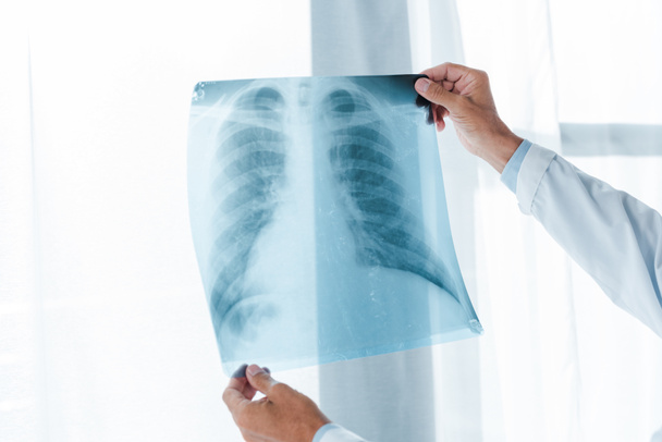 cropped view of doctor holding x-ray in hospital  - Фото, изображение