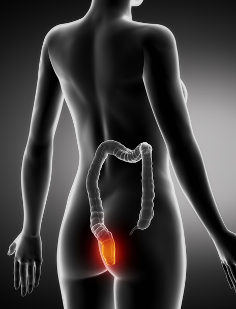 weibliche Hämorrhoiden Konzept Anatomie Röntgen-Hinteransicht - Foto, Bild