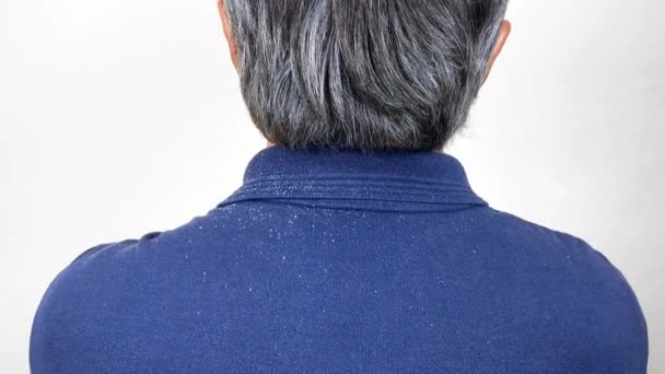 Close-up view of a man who has a lot of dandruff from his hair on his shirt and shoulders. - Footage, Video