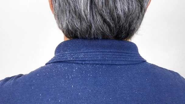 Close-up view of a man who has a lot of dandruff from his hair on his shirt and shoulders. - Footage, Video