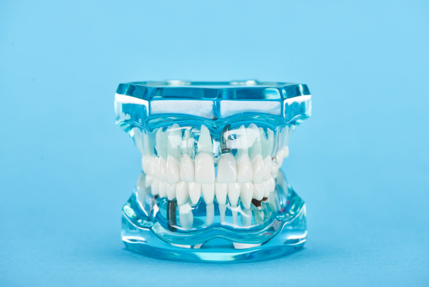 messa a fuoco selettiva del modello di denti con denti bianchi isolati sul blu
  - Foto, immagini
