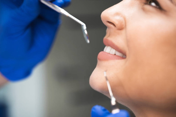 smiling happy brunette woman patient examined by dentist in blue gloves using dental mirror and scaler sitting in dental clinic close up - Foto, Imagen